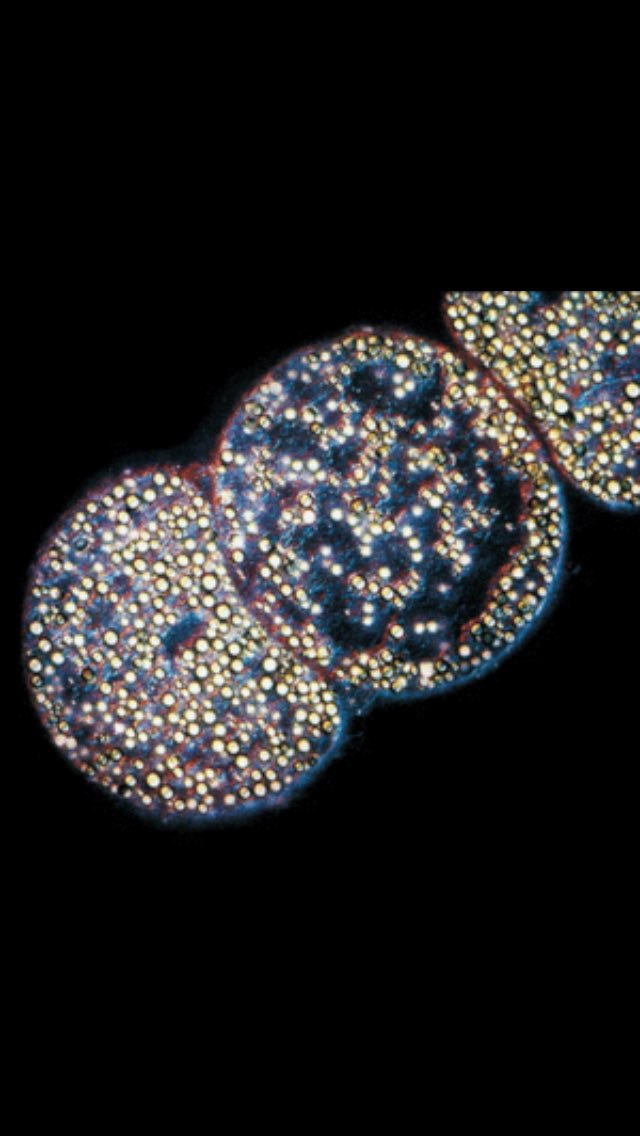 undergraderin's tweet photo. Not the most creative, but I've been dying to draw those vacuoles 😍 #bio350 @markowenmartin https://t.co/XchSWmtOvZ