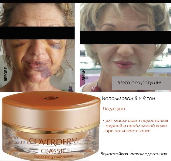 NevenRu's tweet photo. #Синяк, #шрам, #татуировка, #лицо ? Посмотрите, что п��лучается с #Coverderm #Camuflage
https://t.co/do6Ph2vbNc https://t.co/F2Ssfnrzt5