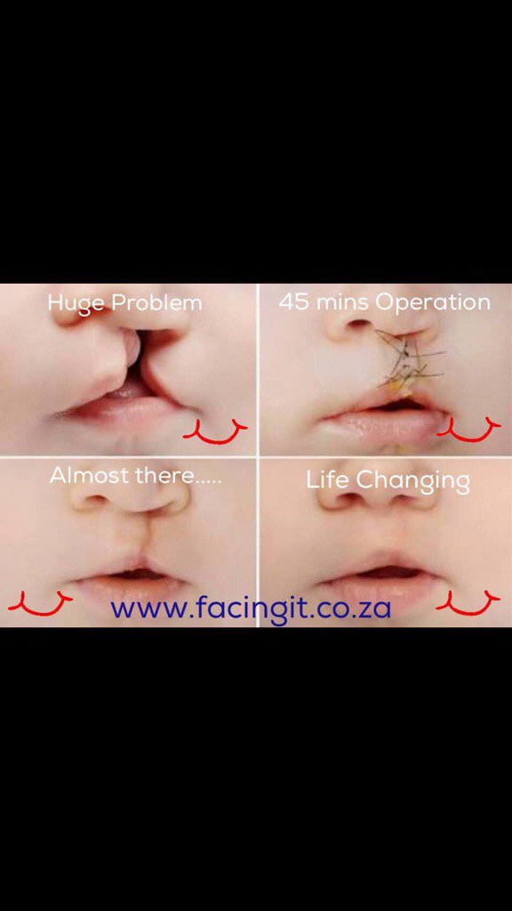 Facing It 2016 (@facingit2015) on Twitter photo No words are required. Just a simple act of kindness <a href="/SmileFundSA/">Smile Foundation</a> <a href="/RowAtlantic2015/">AtlanticChallenge</a> @TaliskerWhisky No words are required. Just a simple act of kindness <a href="/SmileFundSA/">Smile Foundation</a> <a href="/RowAtlantic2015/">AtlanticChallenge</a> @TaliskerWhisky