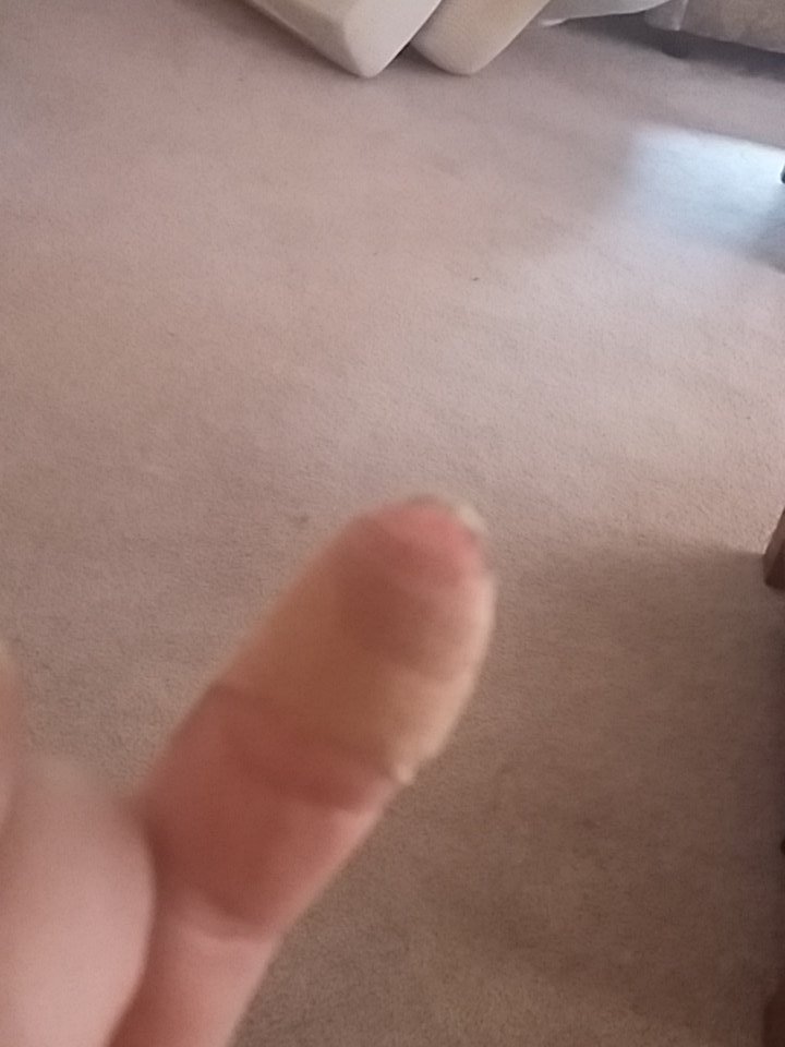 anielamarie1's tweet photo. Cut my finger, tripped up twice... delayed case of the Mondays it is 😣 https://t.co/CYEN5RktEV