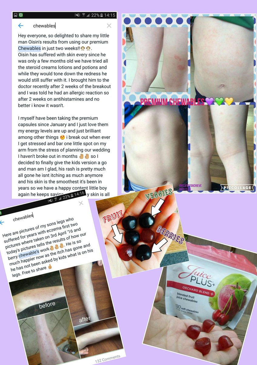 Mrs_Clare_jay21's tweet photo. FREE KIDS CHEWABLES AVAILABLE 👶🍅Has anyone heard of Children's Healthy Study #chs #chewables #healthykids #LNG https://t.co/LpicU24fFx