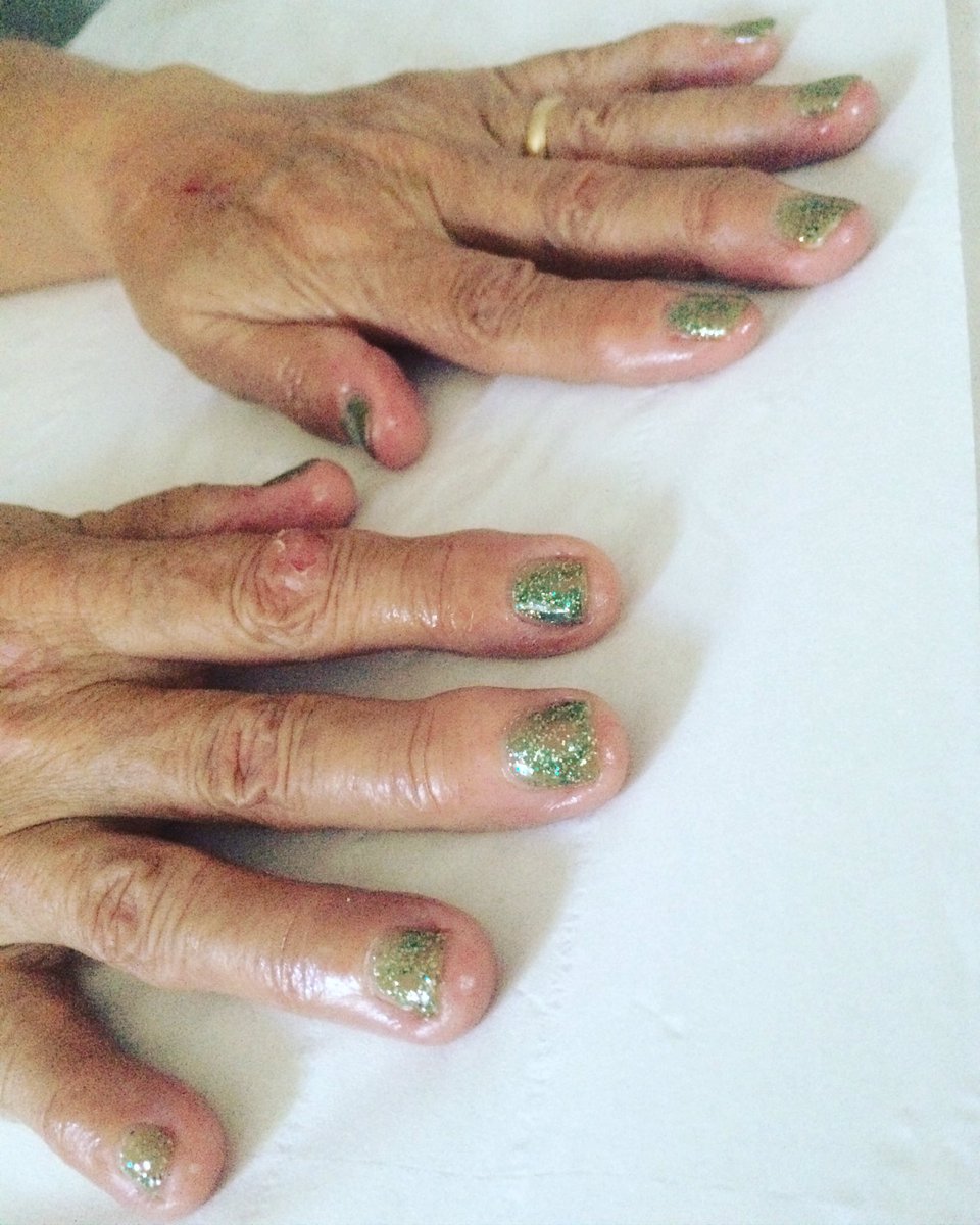 elongatedlocks's tweet photo. Gel Manicure in this new green glitter colour for my Grandma last week! 💚 https://t.co/cncYiCPCge