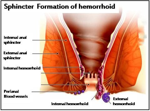 AmroidAimil's tweet photo. #Amroid #Ayurveda #Herbal #NaturalCureForPlies #AyurvedicTreatmentForPiles
#HerbalTreatmentForPiles #Herbalism https://t.co/UyetShUA6U
