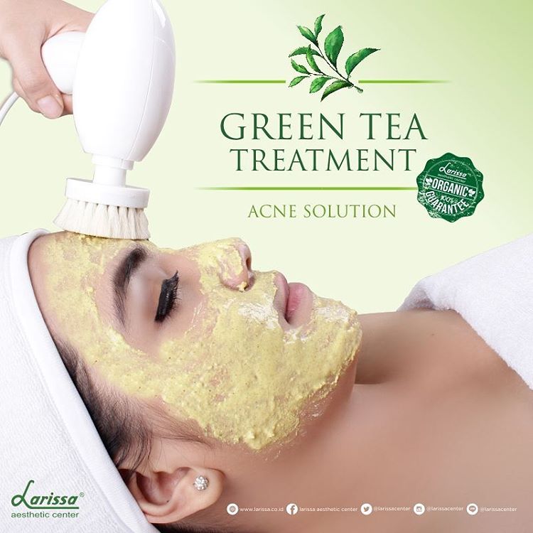 Halo dear, Mau Cantik Alami Bebas Jerawat Dengan Green Tea Facial Larissa ? 
Readmore : goo.gl/8WLLUp