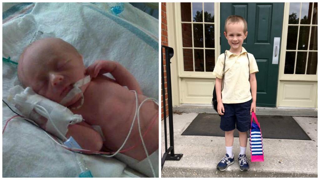 For #NICUtoNow here's Skye, born 6 wks early, just 4lbs, 6oz, who's now a thriving 7 yr old #NICUGrad!