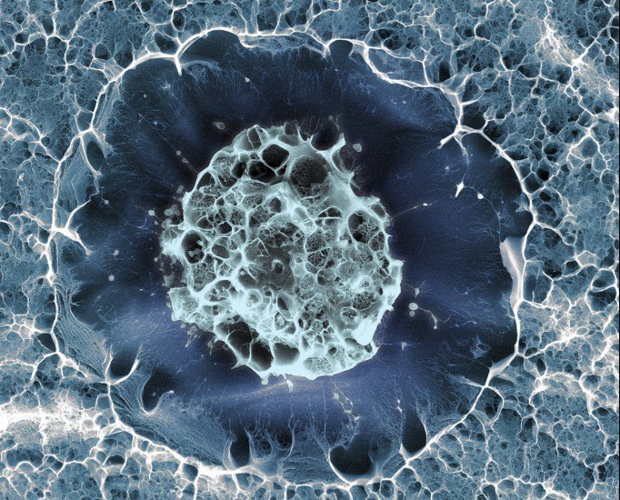 wellcomeimages's tweet photo. The votes have been counted for the Wellcome Image Awards 2016 public vote! Who do you think won? #2016WIA https://t.co/hq6EPriMGM