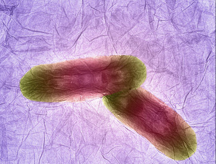 wellcomeimages's tweet photo. The votes have been counted for the Wellcome Image Awards 2016 public vote! Who do you think won? #2016WIA https://t.co/hq6EPriMGM
