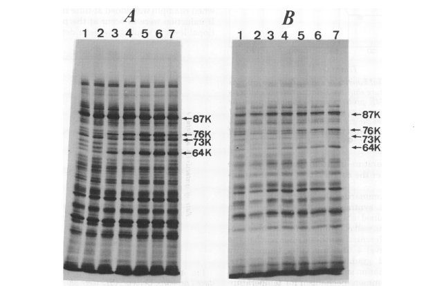 GillesvanWezel's tweet photo. @ASMicrobiology those were the days! #JBact Classic Spotlight: alternative Ο factors https://t.co/zqlwuCnW6s https://t.co/JIcNj1zhpk