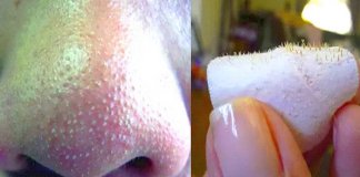 Cómo Eliminar Los Puntos Negros De La Nariz Rápidamente.
VER 👉goo.gl/44l4yC