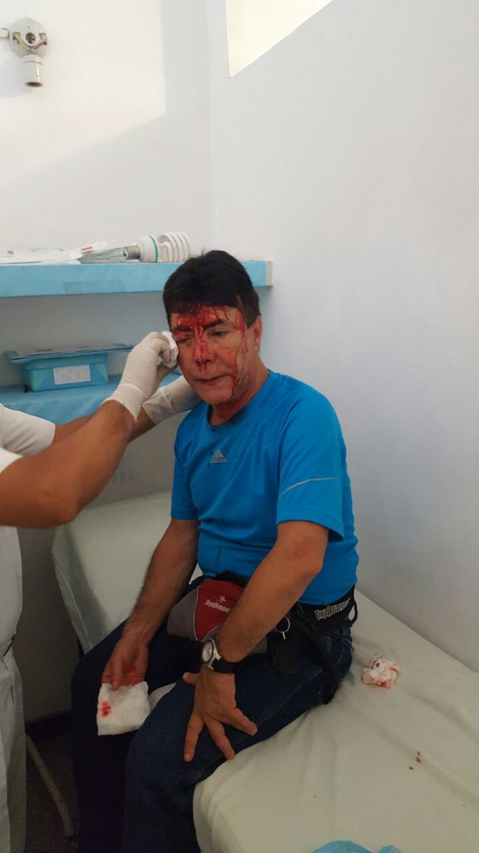 luisreyes1000's tweet photo. Atracado a pistola y herido el presidente de ORA del GPP, Luis Reyes en alcaldía de tucupita en gira n Delta amacuro https://t.co/NmUsxuspHU