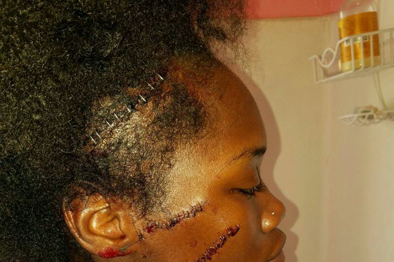 EveryGirlsIdol's tweet photo. I'm raising money on GoFundMe. Please support me: https://t.co/gACDH9iMZ0 @gofundme https://t.co/b696udPuNC