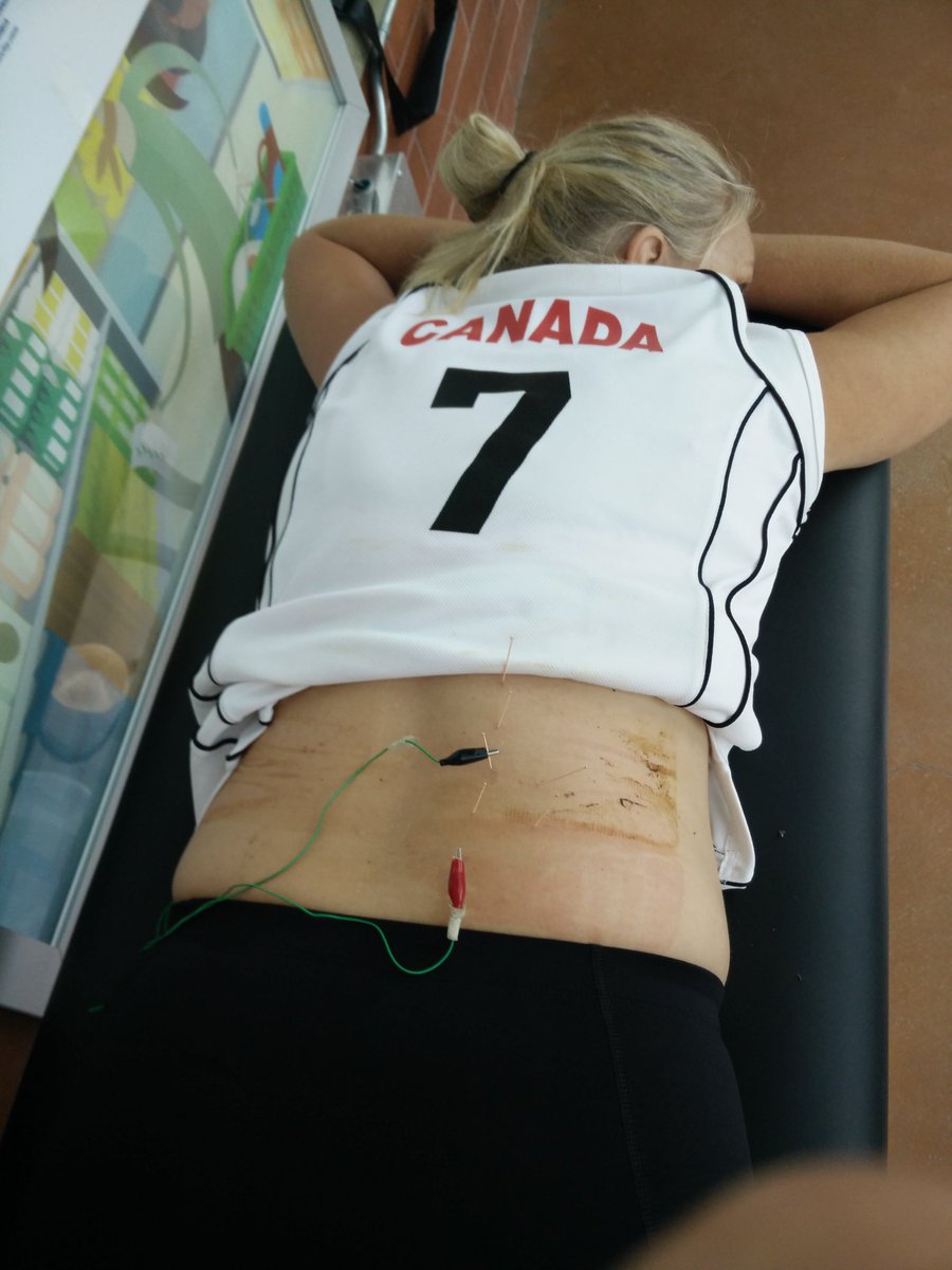 DocSula's tweet photo. I had a great time playing and treating the Canadian volleyball athletes! #AMGames2016 #acupuncture #chiropractic https://t.co/MgKY1mospK
