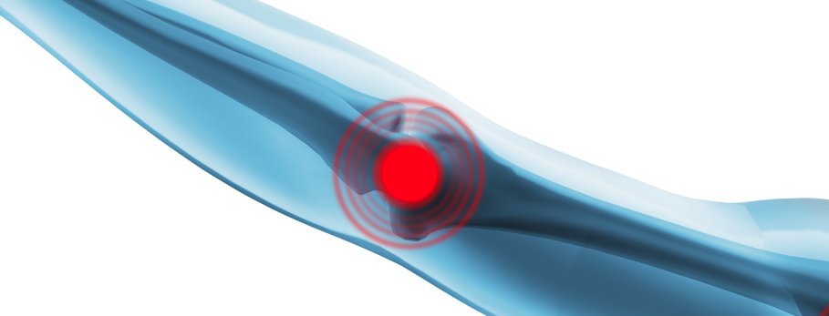 Consultant360's tweet photo. Pearls of Wisdom: Alternative Treatment Options For #TennisElbow // https://t.co/tq7cwwUsQC // #CONpain #jointpain https://t.co/yqMmeDW1qR