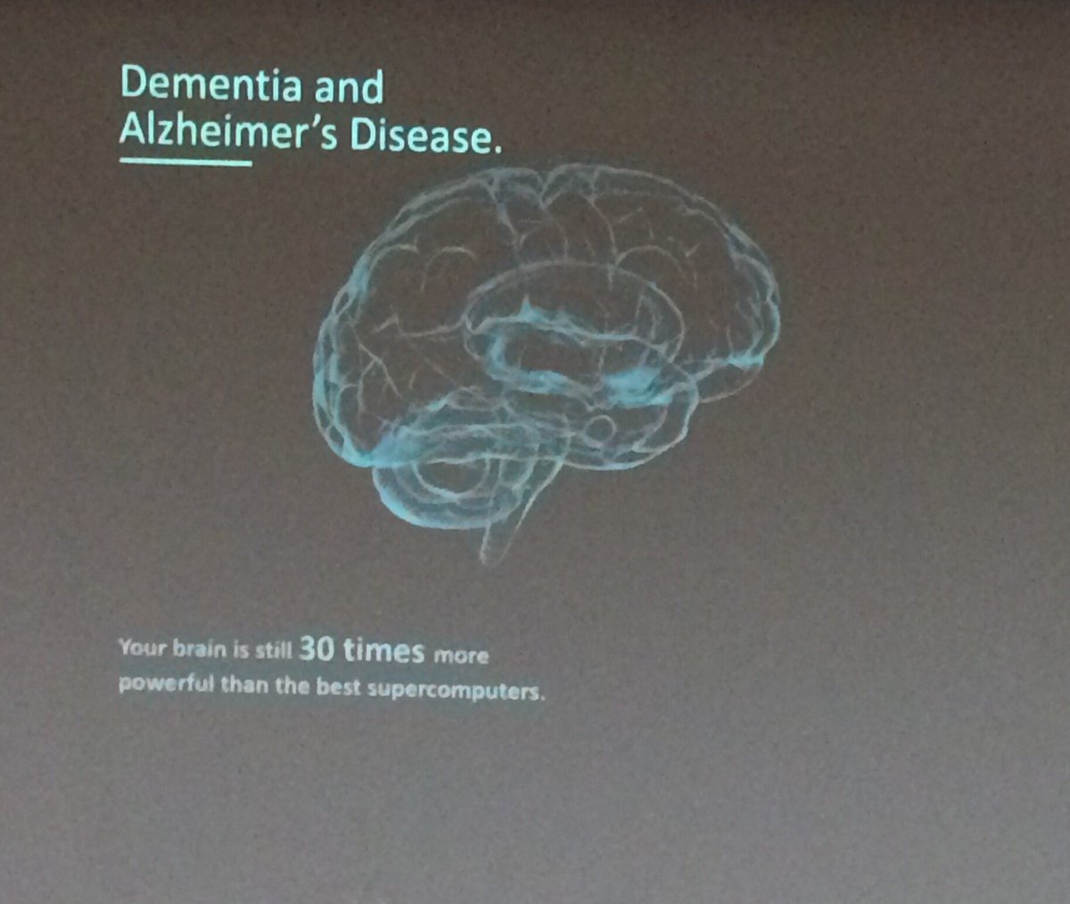 Jt8Teeling's tweet photo. #SoNG2016 Go Alex- your turn -great introduction slide and animations of amyloid and tau- and 🔥inflammation🔥 https://t.co/LG4jHveoii