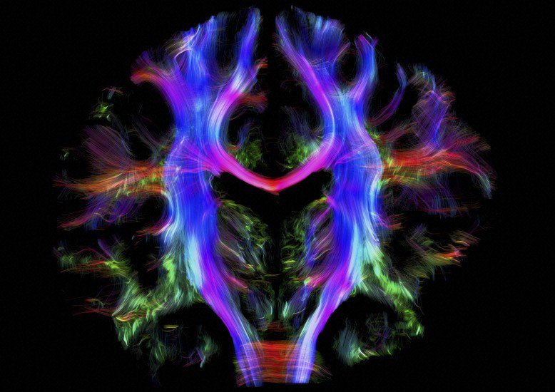 wellcomeimages's tweet photo. *Drumroll*1st place in our #2016WIA public vote goes to @AlfredAnwander's Wiring the Brain! https://t.co/rHnBg2eYLX https://t.co/Khn2TPzmLz
