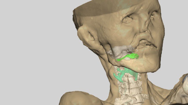 Gizmodo's tweet photo. What Ötzi the Iceman's voice sounded like https://t.co/VRPFP3BA7F https://t.co/3FiyJuOMSY