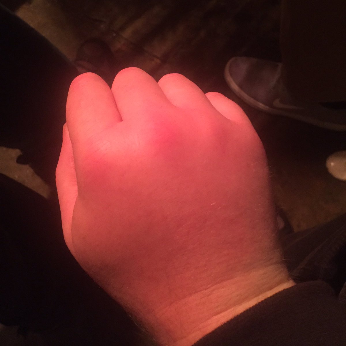 tehfluff's tweet photo. @mattvahiboglu @markymarrow I didn't think I did but I currently have fewer knuckles https://t.co/R6uPwIFHjs