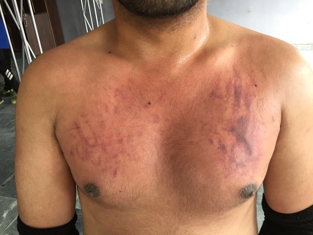 parul_deshwal's tweet photo. Wrestling is not fake watch and then decide its fake or not https://t.co/ny2v6LMbzU