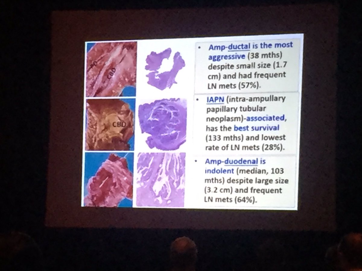 aakasharmand's tweet image. Ampullary lesion classification - Dr Adsay #PathLab2016