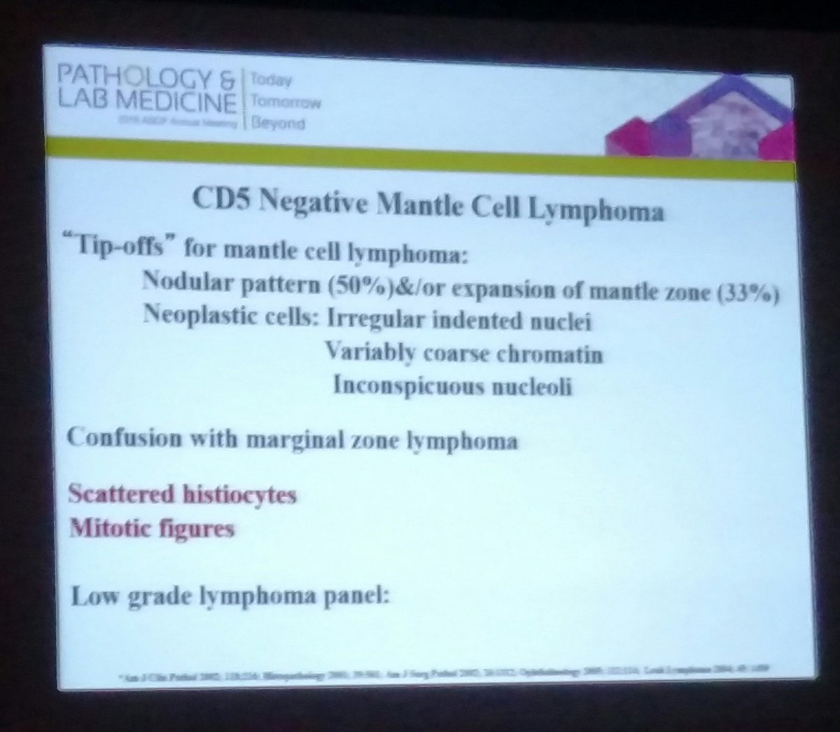 BettyMChung's tweet image. CD5 neg MCL #PathLab2016 #hemepath