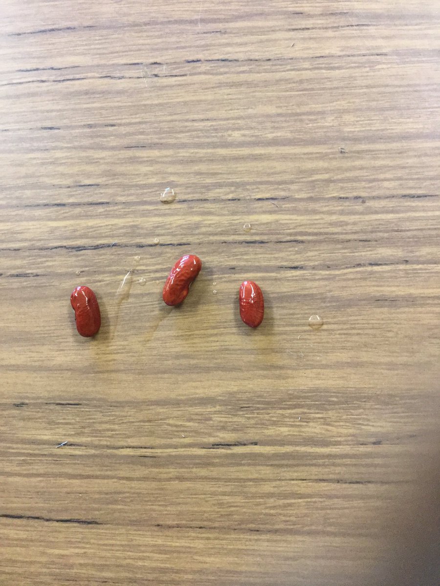 mrscookesclass3's tweet photo. #3a2016 we learned new science words today and dissected seeds. Now we will wait for them to germinate! https://t.co/KguE2xdCfn