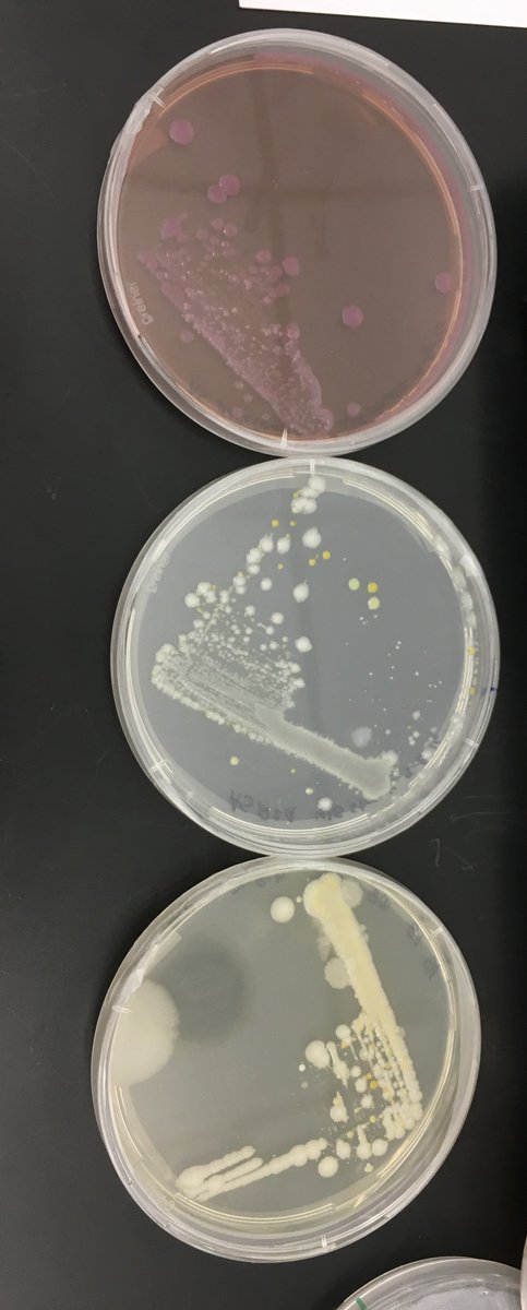 bacteriANNE's tweet photo. found on my plastic nalgene #wbb #bio350 @markowenmartin https://t.co/8ITqpymbAP