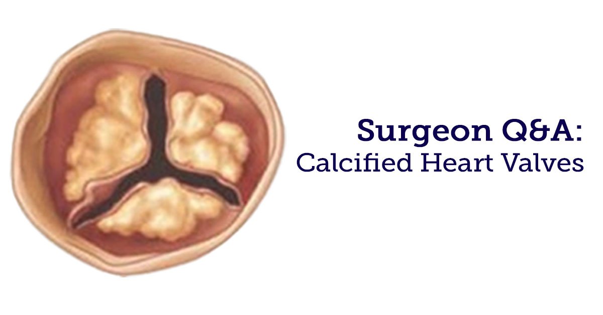 Adam Pick on Twitter "Calcified Heart Valves What 8 Facts Should You