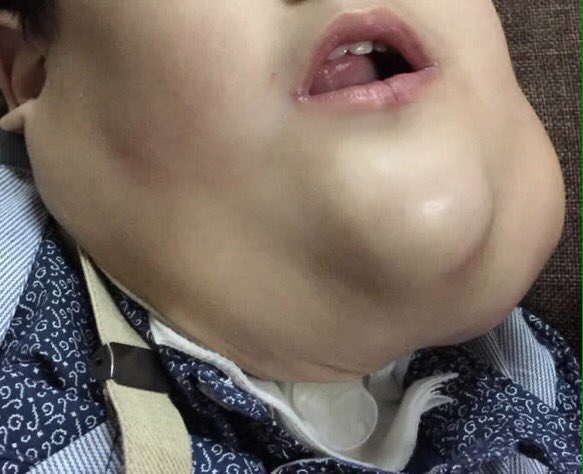 #طفل_سكاكا

اتمنئ من الجمييع المشاركة في هذا الهاشتاق واحتساب الاجر فية نبية يوصل ترند حتئ يلتفت المسؤولين لعلاجة