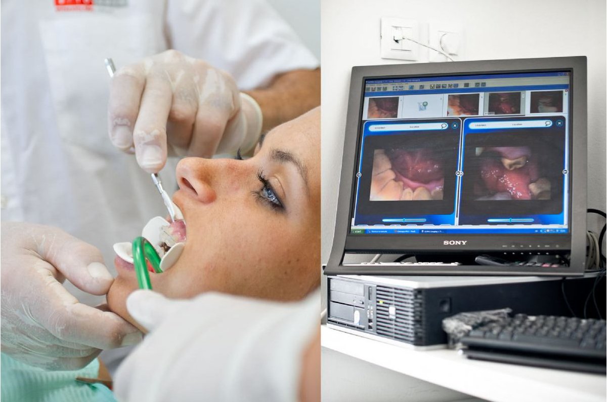 Intraoralna kamera u <a href="/ortonova/">ORTO･NOVA</a> centru! #dentist #medicalpractice