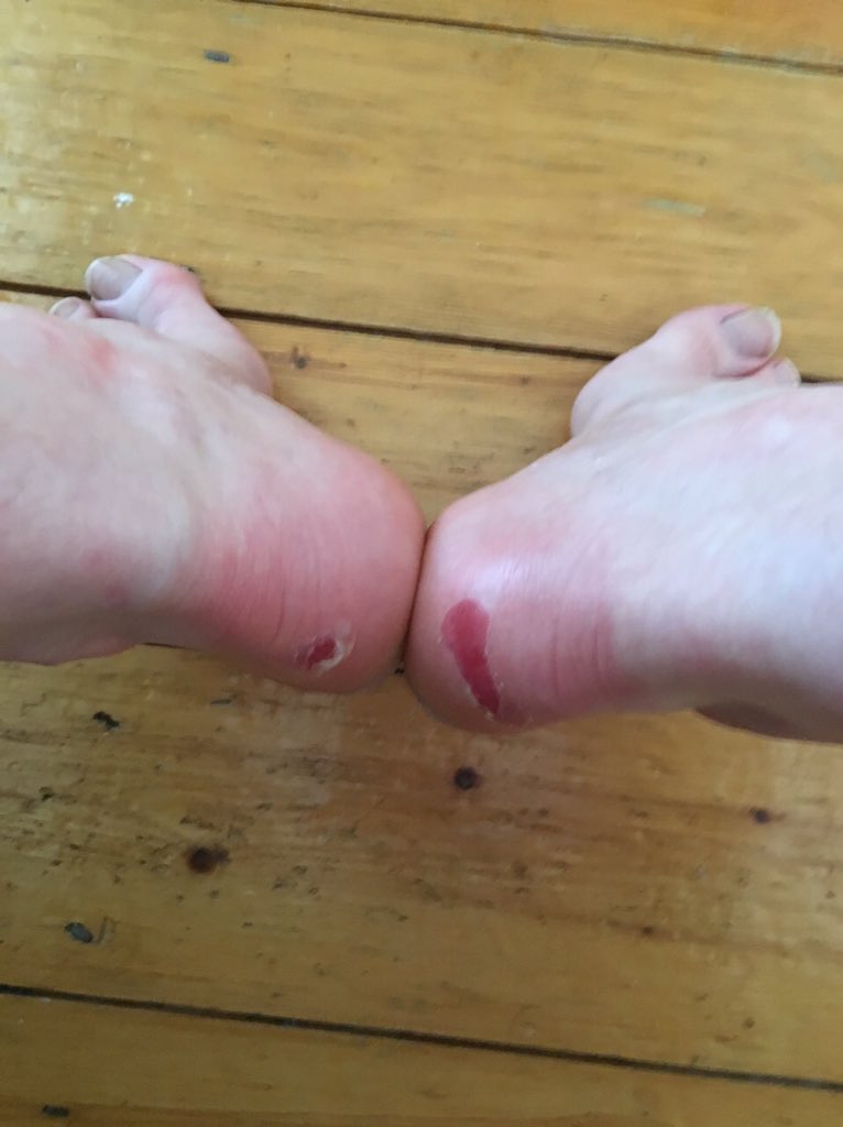 hotshots85's tweet photo. @lifestylesports @flyefit #GiveAFit new boots #WorthIt #ToughenUp https://t.co/WQnIuPpd8N