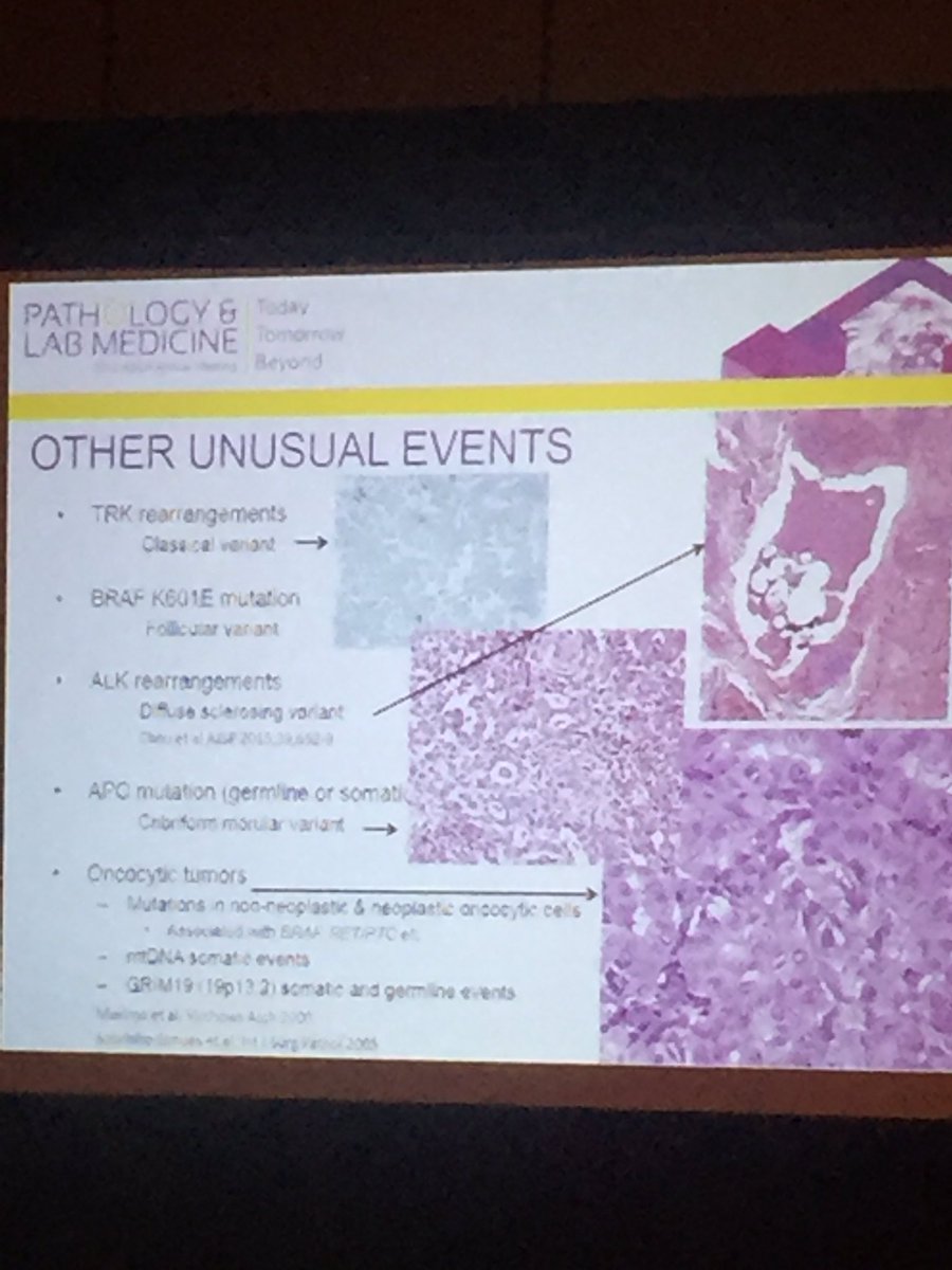 aakasharmand's tweet image. Dr Asa at Endo-path session at #PathLab2016