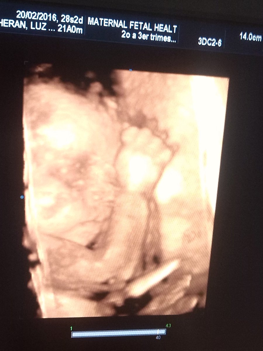 joseEnciso22's tweet photo. #LoMasLindoDePapi la primera foto de.mi.bebe https://t.co/IaRas41KDF