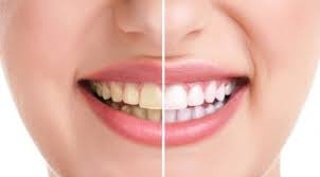 Insotick_ID's tweet photo. Cara memutihkan gigi secara alami.https://t.co/gIjVqQAKJG #gigi #kecantikan #gigiputih #gigisehat #insotick https://t.co/S1ioyXMUzR