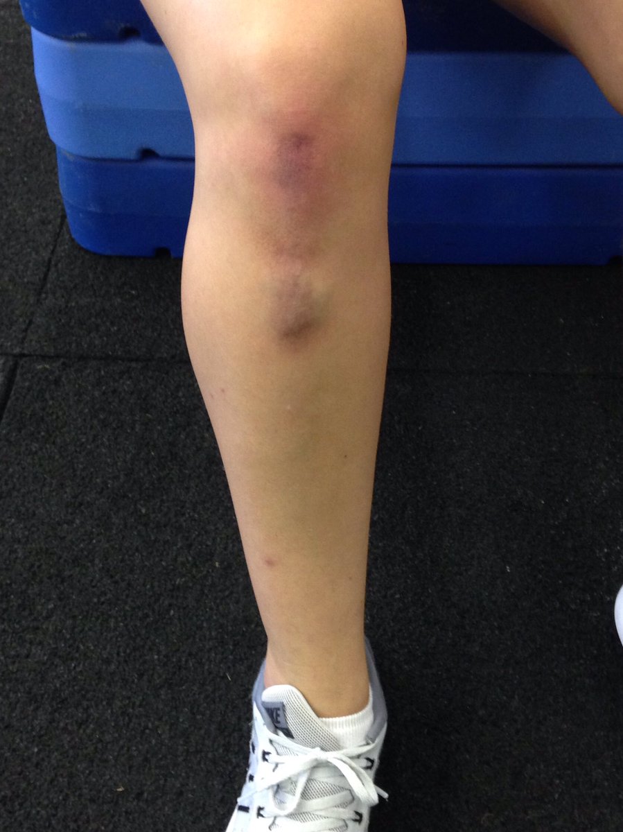 MissCramerMath's tweet image. When you're exhausted on a Friday but coach downs still makes you do boot camp 😵😵 #faceplantfriday