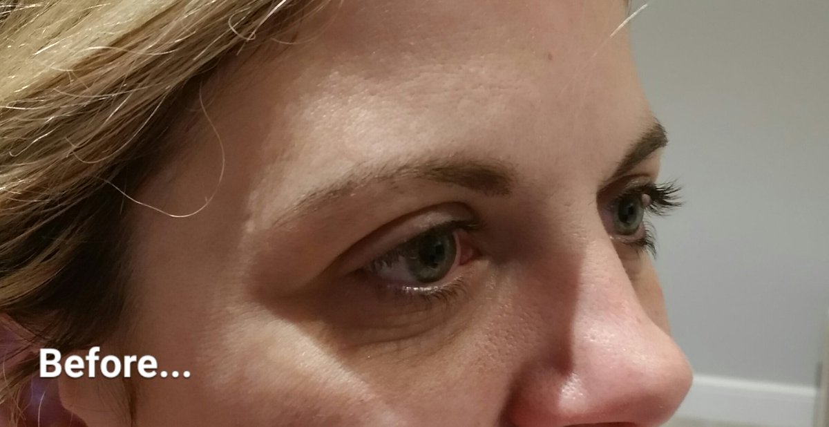 RefinedBrows's tweet image. Refined Brows looking fab! Contact me for appointments #lookinggood #Hitchin #eyebrows