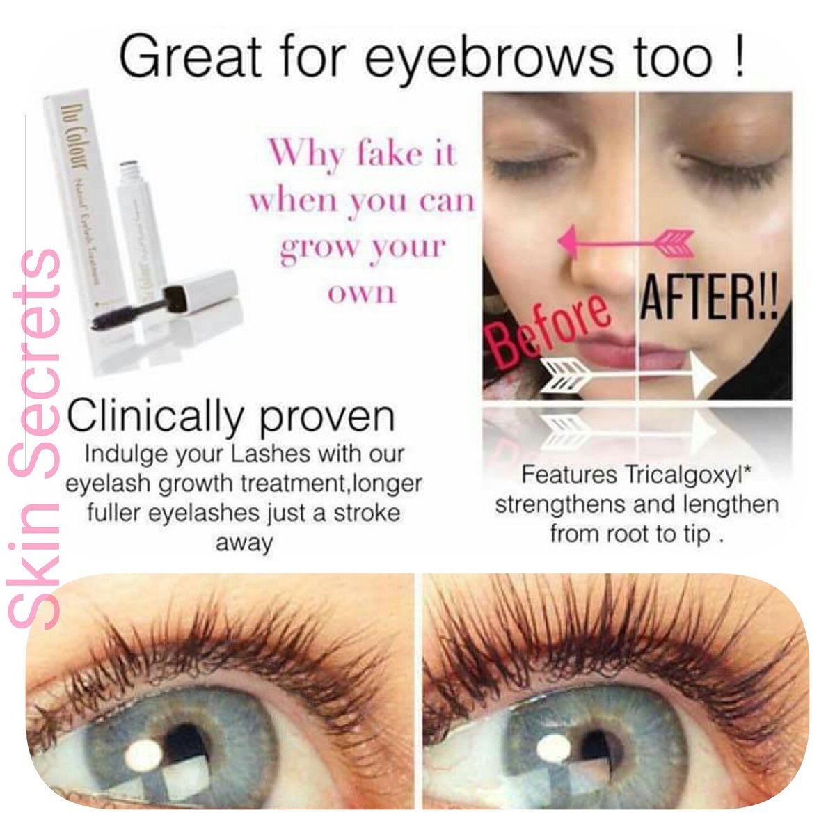 SkinSecret2's tweet photo. Grow your own #lashes #naturally with our #eyelash #treatment, #eyebrows to. #mua #beauty #salon #makeup #mascara https://t.co/ngH4j4x8p0