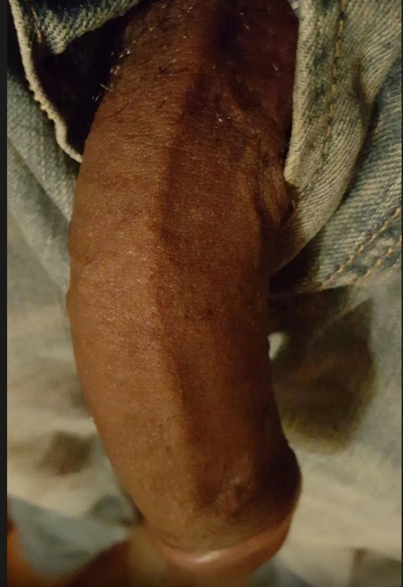 BarefootBottom 🦶🦶 tweet media