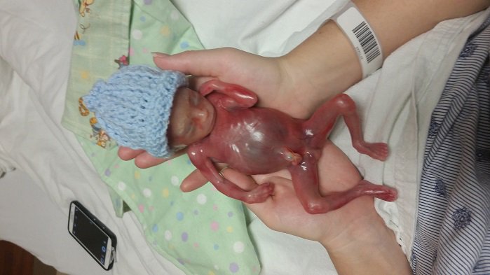 LifeNewsHQ's tweet photo. Parents Release Photos of Baby Boy Who Died at 19 Weeks to Stop Late-Term Abortions https://t.co/eRGfOoDxYy https://t.co/AzzIa5WhAD
