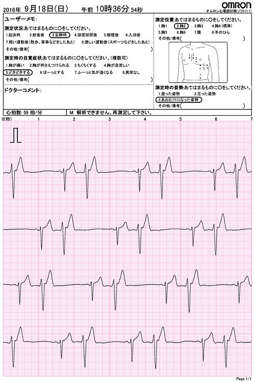 さえずったぁ V Twitter 心電図 今日もドキドキ絶好調 Pvc