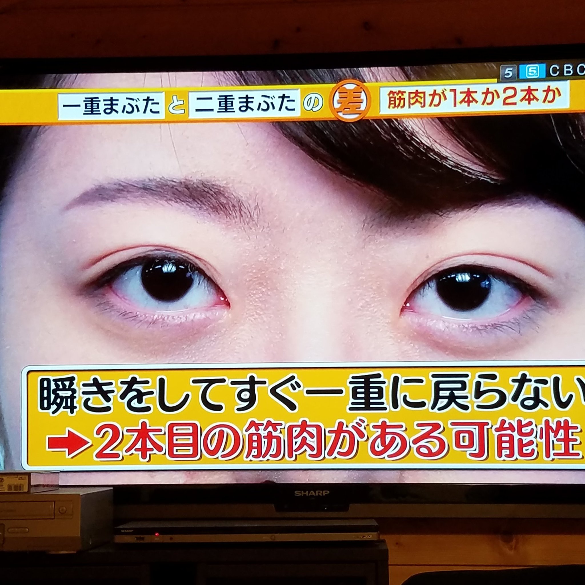 高須克弥 Tbsテレビで二重まぶたのできるメカニズムの説明しでる でたらめ言ってる 一重も二重も筋肉の数はおなじだぜ なう