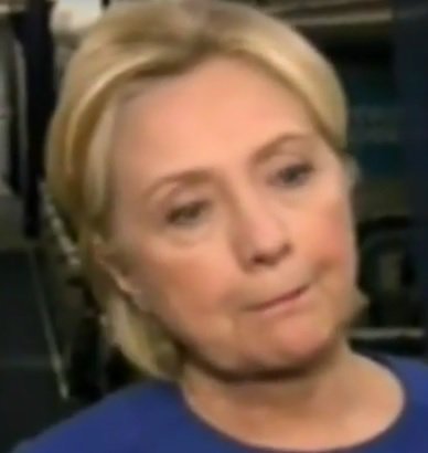 DocRock1007's tweet photo. #SickHillary's #SnoutReflex last night. Her #braindamage shows primitive reflex inhibition loss & #dysconjugategaze https://t.co/ZK9KzkS41c