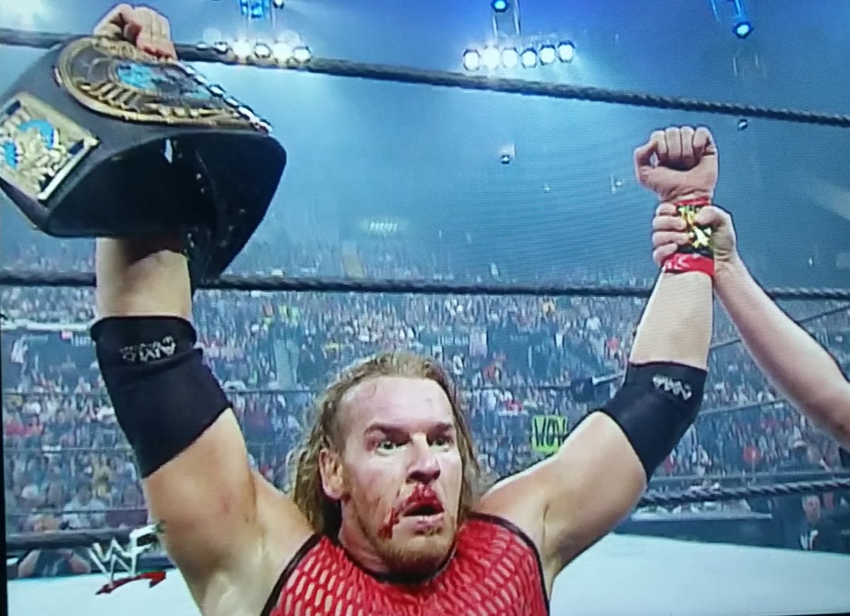 Deadpool1205's tweet photo. A lot less "survivor of epic battle" much more "tripped on shoelace while playing tag"
#Unforgiven2001 @GrappleCast https://t.co/wk8SV09fAD