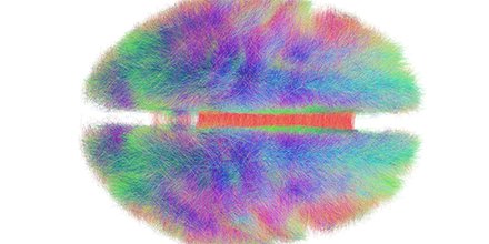 KavliFoundation's tweet photo. What could a #globalbrain initiative look like? It will build on these national projects: https://t.co/YWXM5Da5ot #whbrain #humanbrainproj https://t.co/HilqBN25eS