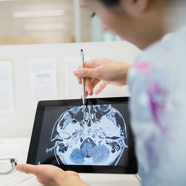 PreventionMag's tweet photo. 6 foods you should avoid, according to brain docs: https://t.co/IgqaXI17Rl https://t.co/AYMmdN81tv