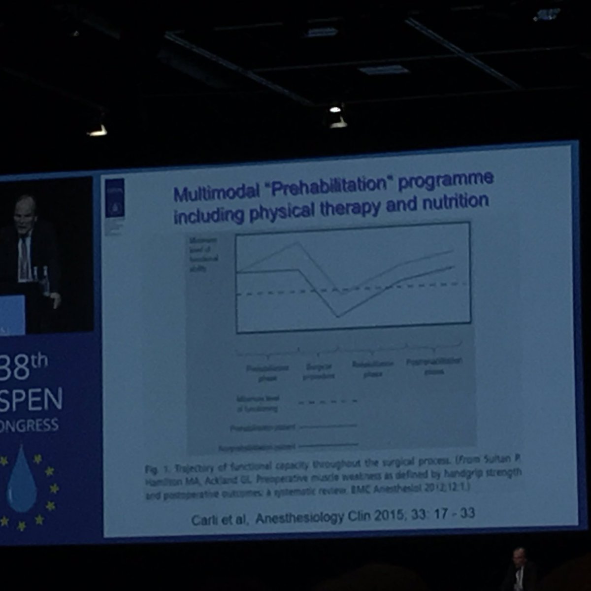 jicurryNI's tweet photo. #ESPEN2016 guidelines for surgery: evidence supporting #ERAS as 1st approach @ERASsocietyUK & combination of immunonutrition for bowel Sx https://t.co/TTKf18RtfL