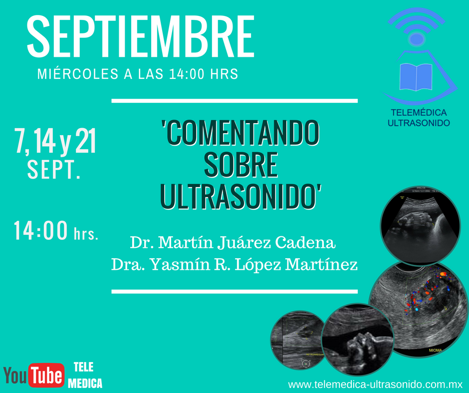 ceuldi's tweet image. Miércoles a las 14:00hrs 
TRANSMISION EN VIVO 
youtube.com/watch?v=Ye3M6N…
