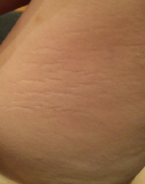 MiroslavToiLesM's tweet photo. Les #InspiBodyPosi de septembre 2016 sont làààà https://t.co/60gclzr6BT 💕 #BodyPositive #EffYourBeautyStandards (le blog est à jour \o/) https://t.co/0rGwSgbsHU