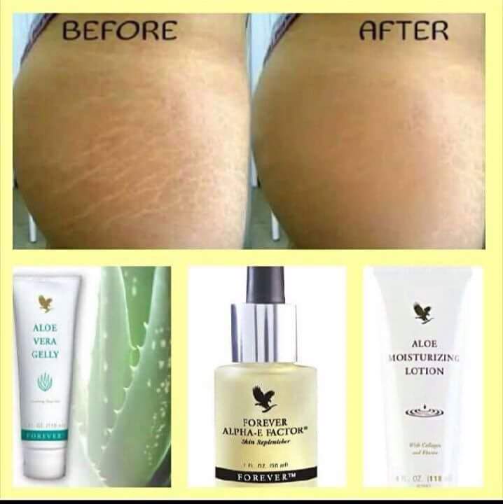 Phiwok's tweet photo. Interested in Buying or Being Part of the Business Halla @ me. Forever living Products. #DropADM #ForeverLiving https://t.co/n29ryHpEx8