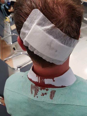 WitsVuvuzela's tweet photo. #Wits lecturer &amp; @WitsAcademics head @DavidJHornsby has been released from today. He sustained injuries during the protests today. https://t.co/pKANcV5z6s