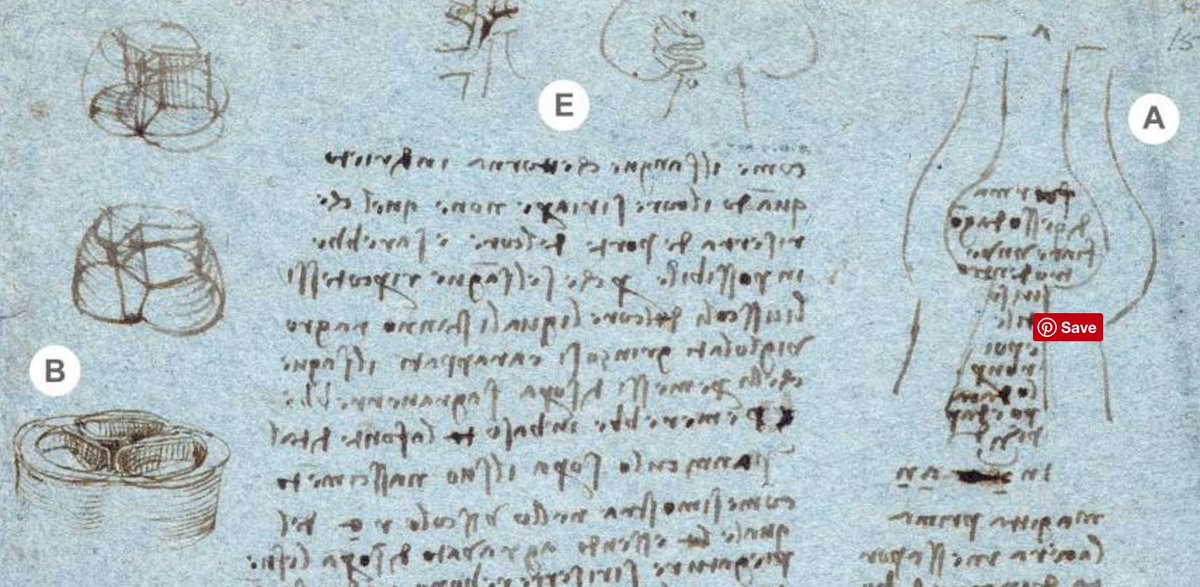 MedCrisis's tweet photo. Da Vinci realised the sinus of Valsalva creates vortices that actively shut the aortic valve early to minimise regurge

Proven 450 yrs later https://t.co/0dg49f9ii3